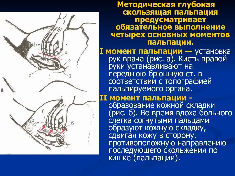 Пальпация живота. Глубокая методическая скользящая пальпация. Глубокая методическая скользящая пальпация живота. Глубокая пальпация методика. Порядок проведения глубокой пальпации.