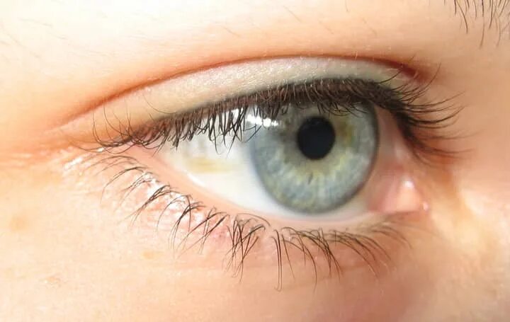 верхний ряд ресниц. нормальные ресницы. двойной ряд ресниц дистихиаз. двойной ряд ресниц. верхний ряд ресниц.