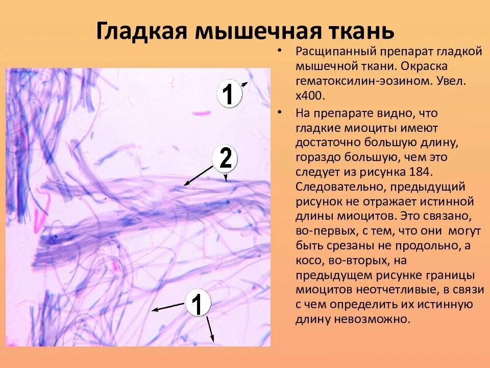 Гладкая мышечная ткань источник. Гладкая мышечная ткань препарат. Гладкая мышечная ткань строение. Гистогенез мышечной ткани. Гладкая мышечная ткань. Окраска гематоксилином и эозином.