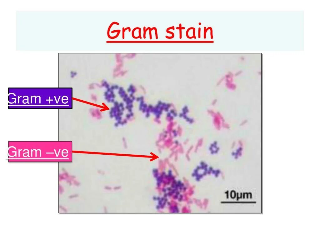 Грамм отрицательные палочки в мазке. Gram staining. грамположительные и грамм отрицательные бактерии. стрептобацилла окраска по граму препарат. метод грама.