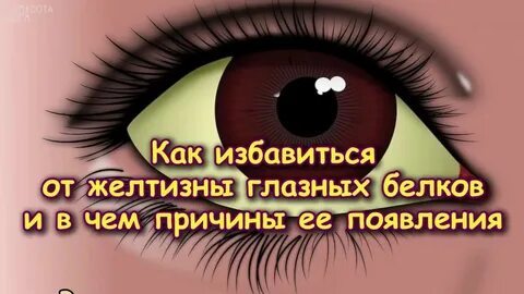 Как отбелить белки глаз от желтизны