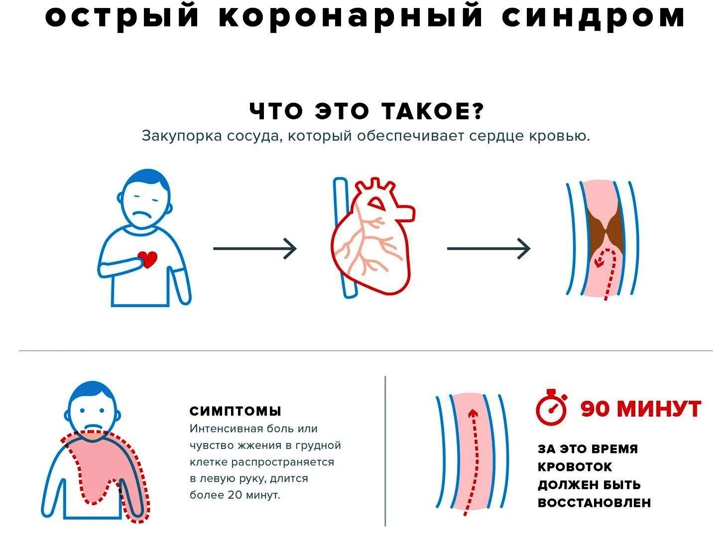 Коронарные осложнения. Синдром острой коронарной недостаточности симптомы. Острый коронарный синдром симптомы. Симптомы остром коронарном синдроме. Острого коронарного синдрома (Окс) неотложная помощь.