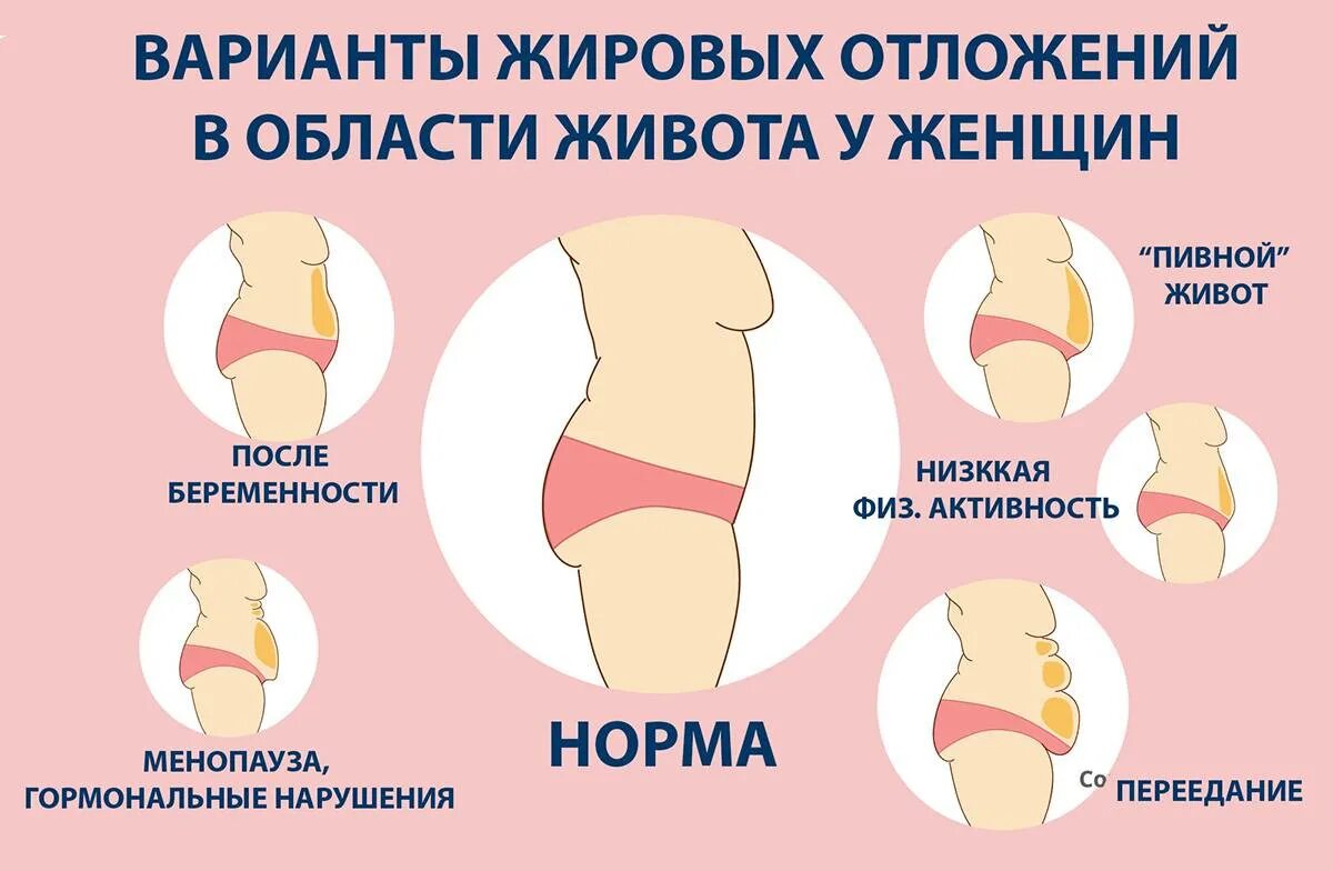Виды живота. Разновидности живота у женщин. Гормональный живот. Виды жира на животе