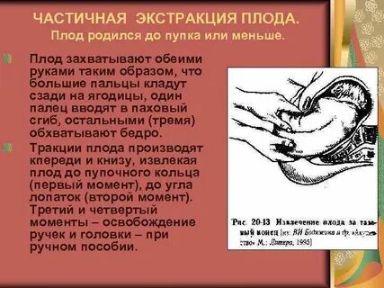 Экстракция плода