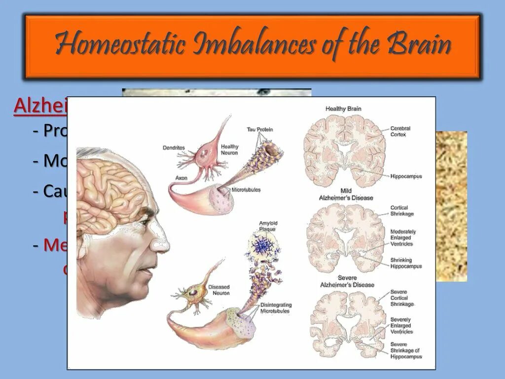 Brain disorders. Болезнь Альцгеймера гиппокамп. Животные болезнь Альцгеймера. Болезнь Альцгеймера плакат. Болезнь Альцгеймера мозг в разрезе.