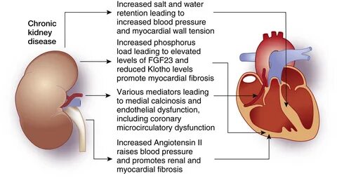 Chronic kidney disease