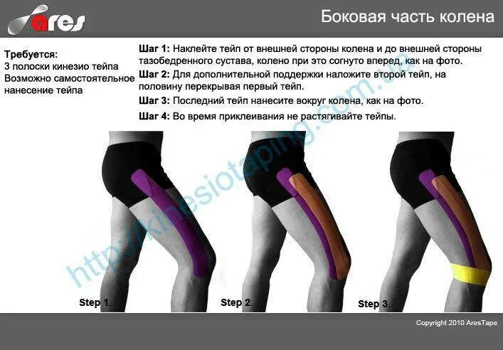 После бега болят колени что делать. Болит колено сбоку с внешней стороны. Наружная сторона колена. После бега болит колено с внутренней стороны. Болят колени при беге.