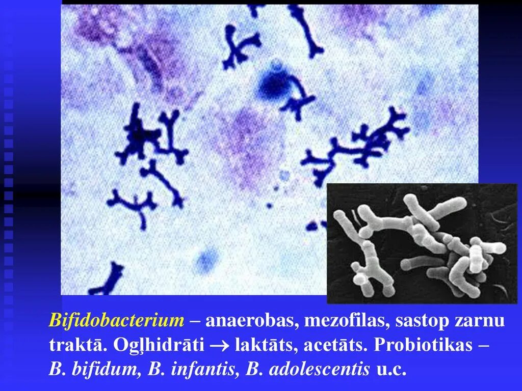 Бифидобактерии где. Bifidobacterium bifidum в микроскопе. Bifidobacterium bifidum по Граму. Bifidobacterium bifidum 1. Bifidobacterium морфология.