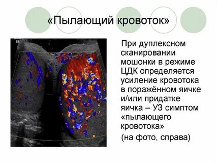 Желез усиливает кровоток