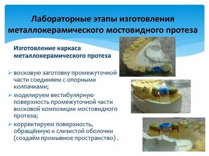 Пластмассовые коронки клинико лабораторные этапы