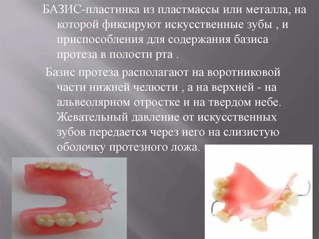 Привести в базисы. Базис съемного пластиночного протеза. Съемный пластиночный протез с металлическим базисом. Съёмный пластиночный протез в полости рта.