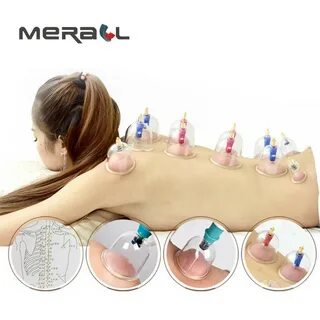 Chinese Vacuum Cupping Kit Ventouse Anti Cellulite Suction - AliExpress