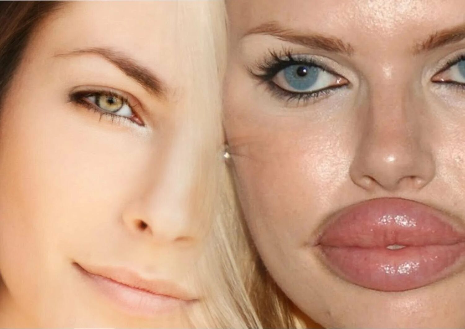 Форма губ бант. Нарощенные губы. форма губ пухлый бантик.