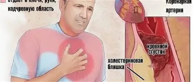 У женщины посередине грудной клетке жжение