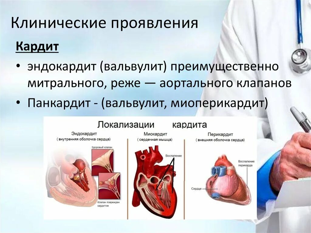 Эндокардит симптомы и лечение. Симптомы ревматизм кардит. Эндокардит миокардит перикардит панкардит. Перикардит инфекционный эндокардит. Эндокардит клинические проявления.