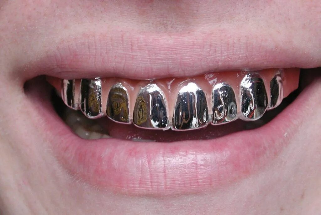 коронка цельнолитая (сплав remanium). стальная коронка на зуб. металлическая коронка. стальная коронка на зуб. штампованно паяные мостовидные протезы.