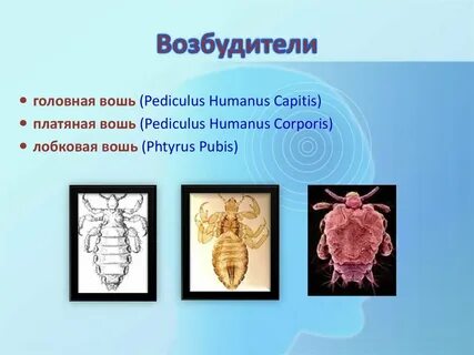 Вши возбудители