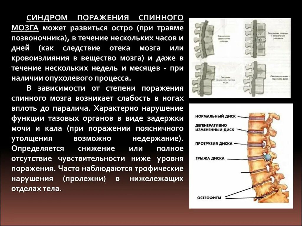 Симптомы поражения шейного отдела спинного мозга. Повреждение спинного мозга в поясничном отделе. Травма поясничного отдела спинного мозга. Перелом спинного мозга симптомы.