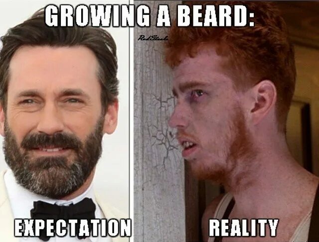 Doesn t grow. Борода Мем. Плешивая борода Мем. Квадратная борода Мем. Общипанная борода Мем.