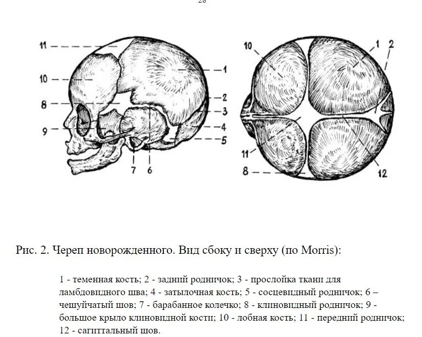 Швы и роднички черепа. Стреловидный шов черепа. Кости и швы черепа новорожденного. Швы черепа анатомия. Кости родничков