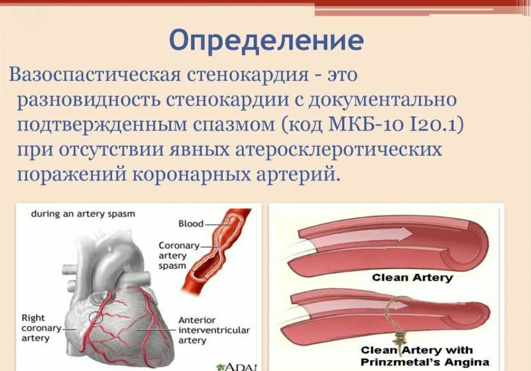 Аортальная стенокардия. Стенокардия принцметала на экг. Портальная недостаточность. Аортальная стенокардия. Ишемия стенокардия инфаркт.