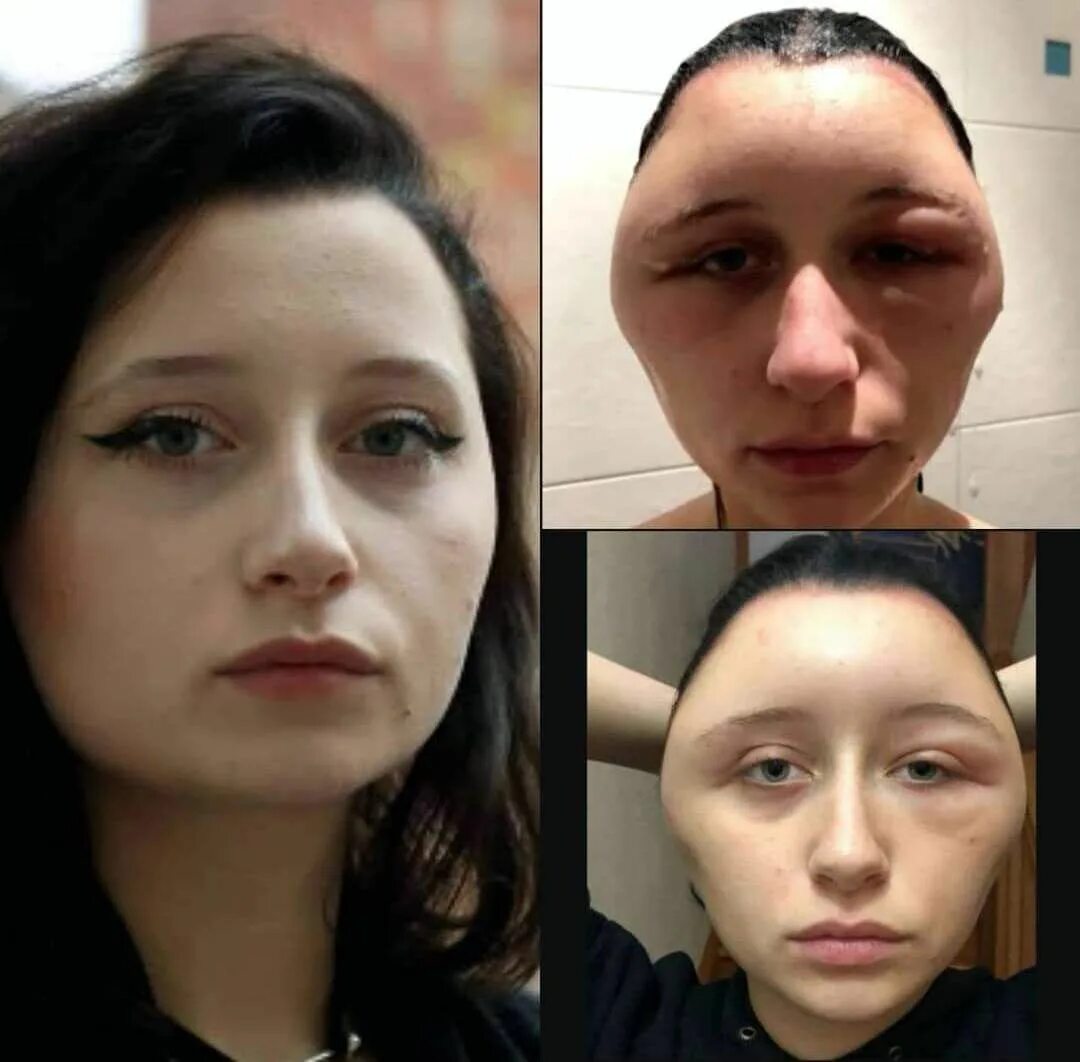 Кожа после покраски