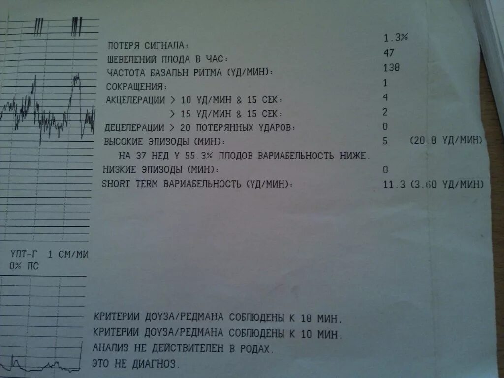 КТГ плода на 32 неделе беременности. Норма кто плода 30 недель. Вариабельность КТГ плода норма 32 недели. Расшифровка КТГ плода 34 недели беременности. 19 недель нет шевелений