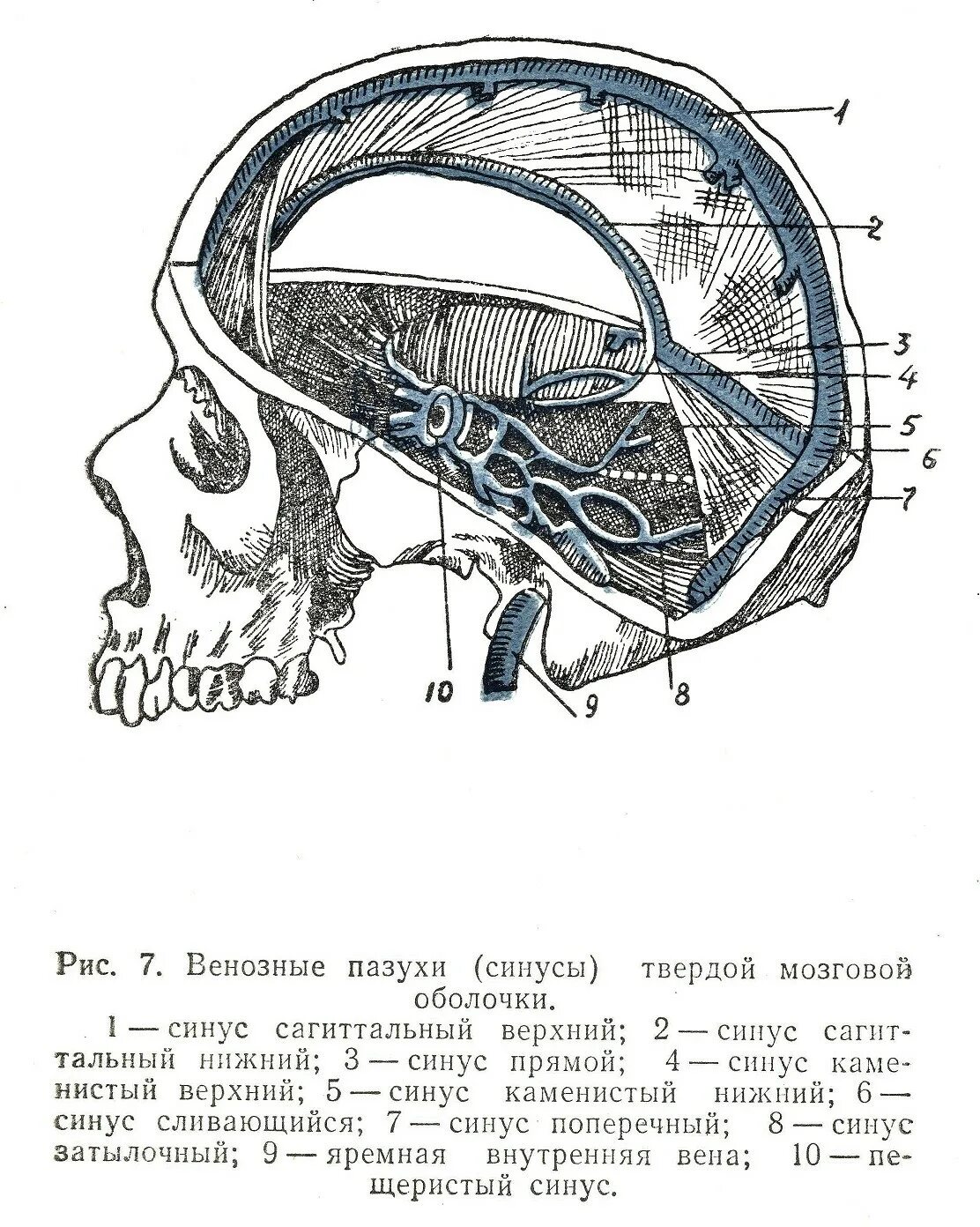 Синусы твердой оболочки мозга. Синусы твёрдой мозговой оболочки анатомия. Синусы твердой мозговой оболочки на черепе. Синусы твердой мозговой оболочки схема. Сигмовидный синус твердой мозговой оболочки.