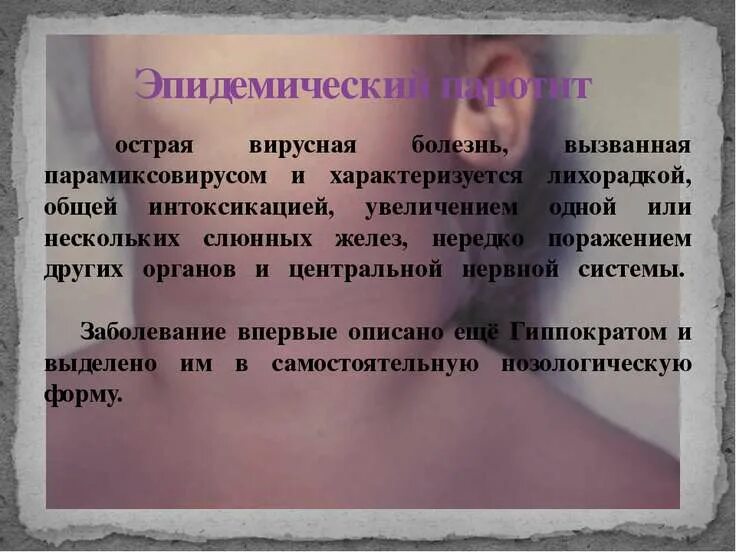 Паротит симптомы и лечение. Эпидемический паротит периоды. Свинка эпидемический паротит. Свинка болезнь инкубационный период. Инкубационный период паротита у взрослых.