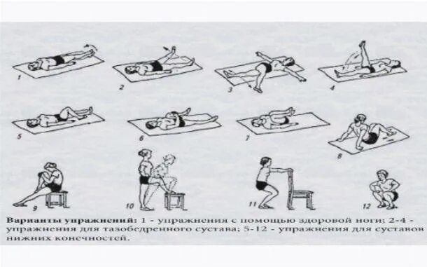 Гимнастика после инсульта комплекс упражнений. Реабилитация после инсульта ЛФК упражнения. Лечебная физкультура после инсульта комплекс упражнений. Комплекс лечебной физкультуры после инсульта.