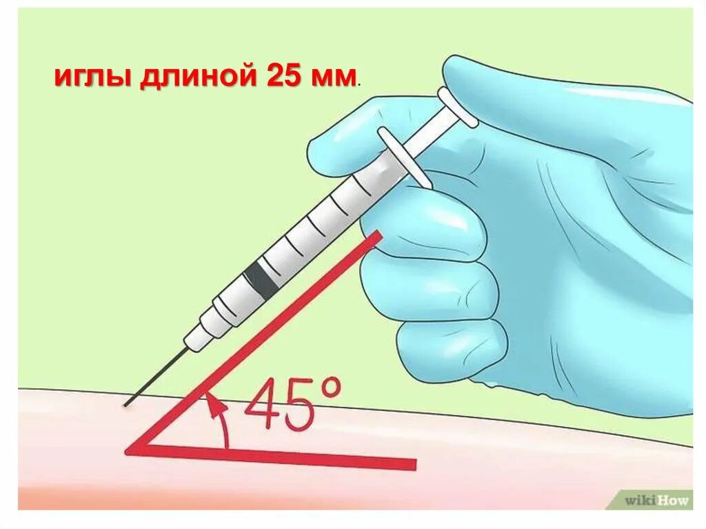 Иглы для подкожных инъекций. Подкожная инъекция введения иглы. Шприц для подкожного введения.