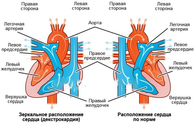 Левая сторона 11. Аномалии расположения сердца. Аномальное расположение сердца.