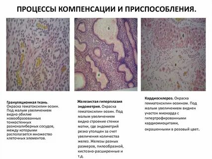 Патологическая ткань