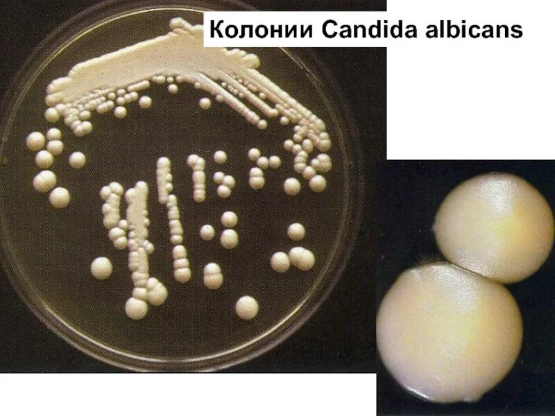 Грибы candida albicans. Candida альбиканс. Дрожжеподобный гриб Candida albicans.