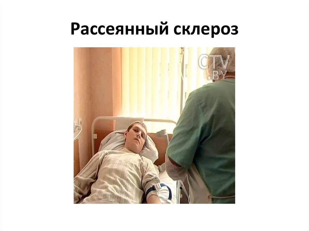 Операция рассеянный. Рассеянный склероз. рассеянный склероз симптомы. рассеянный склероз фото. симптомы рассеянного склероза.