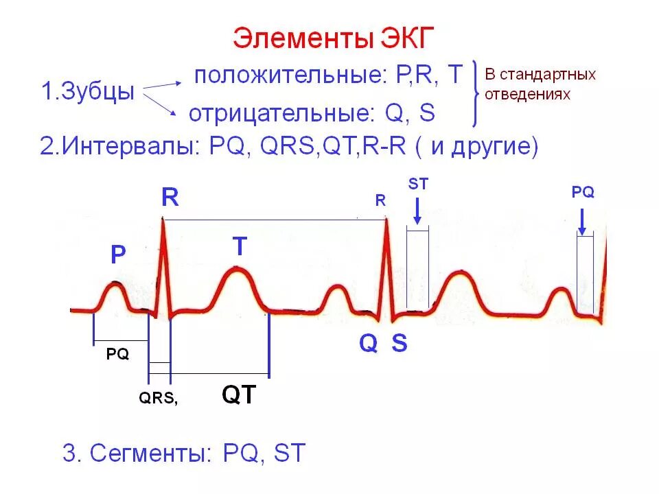 ЭКГ схема зубцов и интервалов. Компоненты нормальной ЭКГ. Элементы нормальной ЭКГ. Нормальное ЭКГ 1 цикл. Как делают экг взрослым