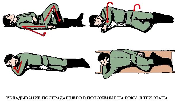 нарушение сознания при чмт. черепно-мозговая травма без потери сознания. клинические проявления ушиба головного мозга. тяжелая черепно-мозговая травма. оказание первой помощи при сотрясении головного мозга.