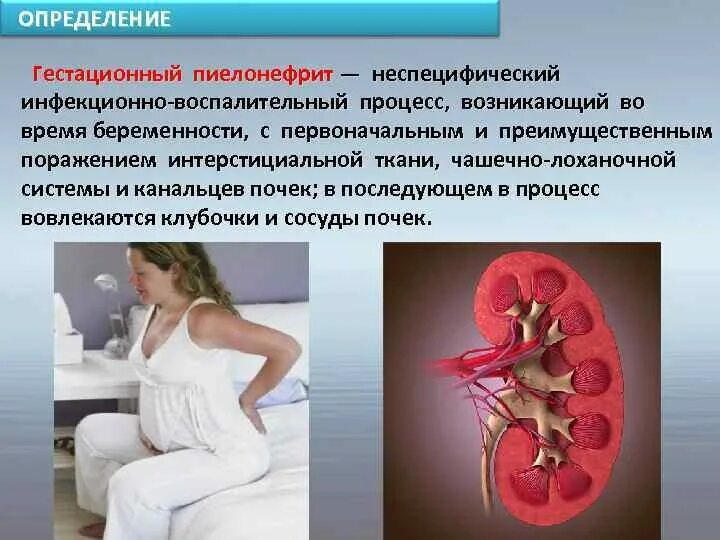 2 триместр болят почки