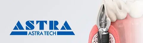 Astra tech импланты отзывы
