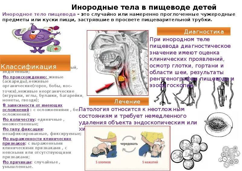 Проглотил через сколько выйдет. Инородные тела в организме. Инородные тела пищевода. Инородный предмет в пищеводе у ребенка симптомы. Инородное тело профилактика.