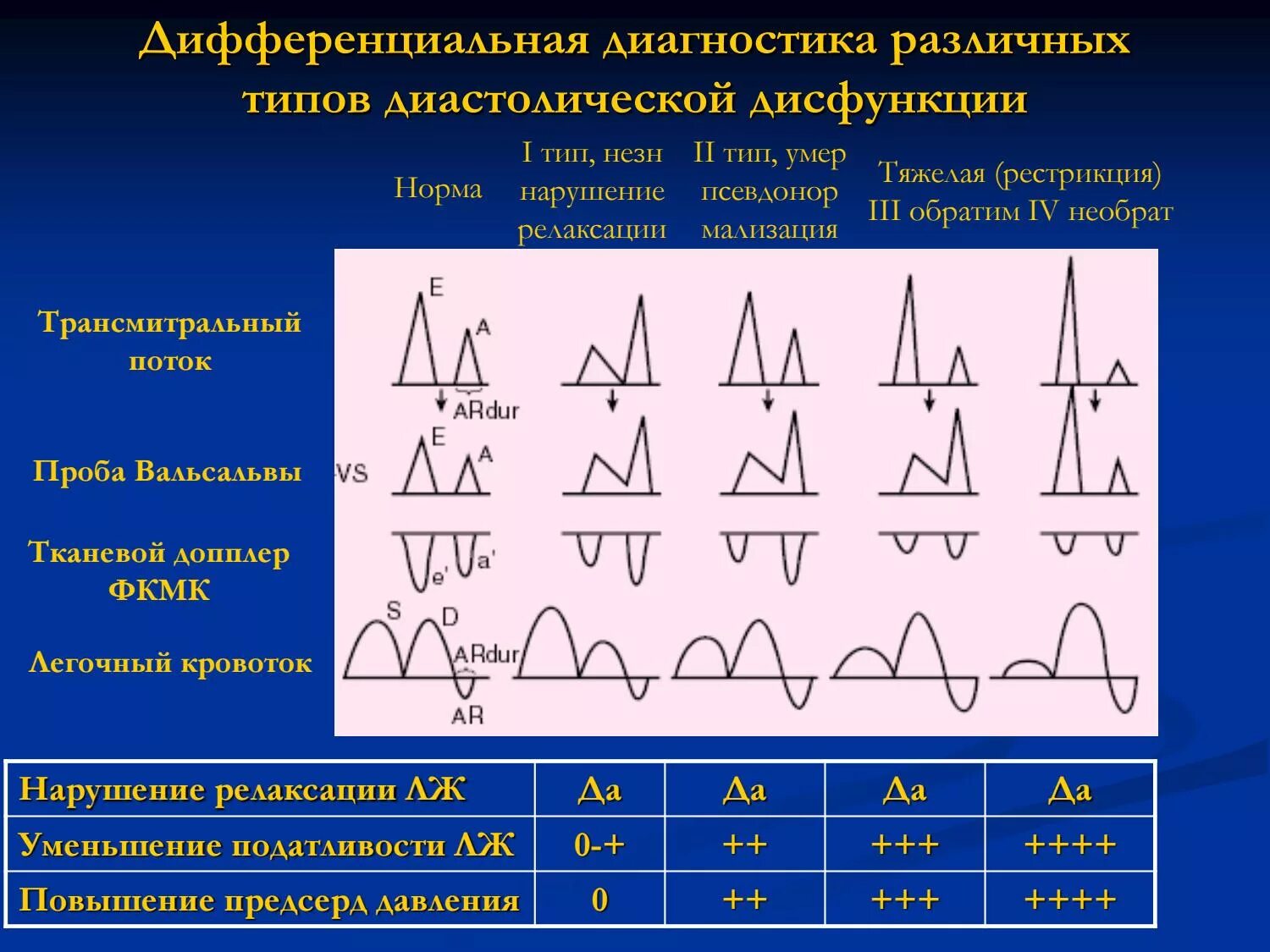 Степени диастолической дисфункции. Нарушение диастолической функции типы. Типы диастолической дисфункции левого желудочка. Алехин эхокардиография диастолическая дисфункция. Диастолическая дисфункция лж 3 типа.