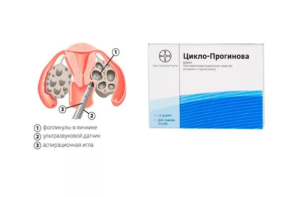 Препарат для стимуляции фолликулов. Лекарство для стимуляции фолликулы. Препараты для стимуляции яичников. Препараты для гормональной стимуляции яичников. Прогинова после переноса