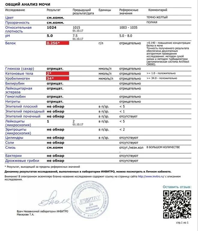 Белки и лейкоциты в моче причины. Общий анализ мочи. Общий анализ мочи анализ. Общий анализ мочи при. Общий анализ мочи Результаты.