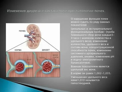 Почечный диурез