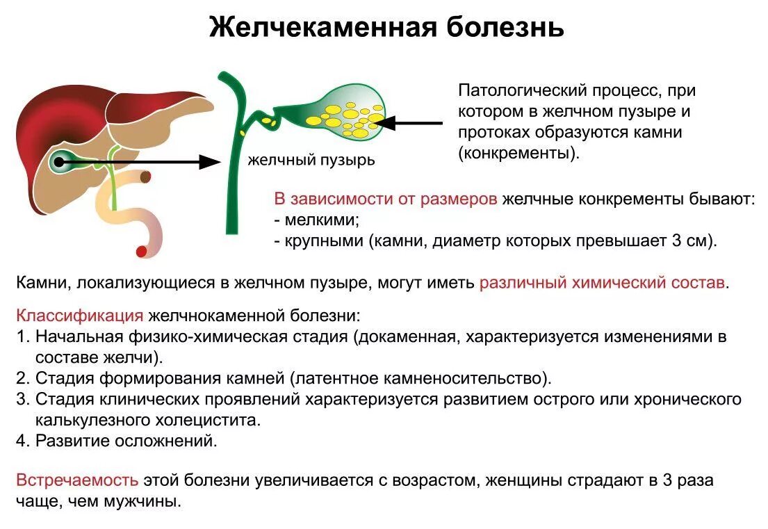 Желчекаменная болезнь(ЖКБ) симптомы. Причины образования желчных камней. Симптомы, характерные для поражения желчного пузыря. Желчнокаменная болезнь (ЖКБ).