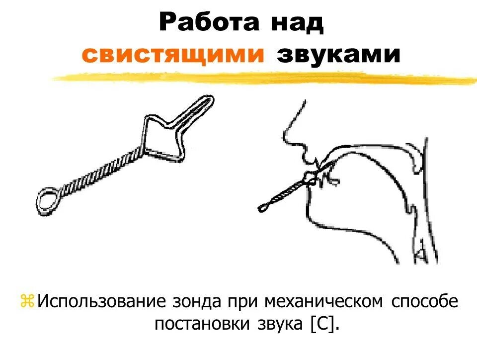 Как поставить твердый звук. Постановка звука с с помощью зонда. Логопедические зонды для свистящих звуков. Постановка звука с механическим способом. Постановка звуков с помощью логопедических зондов.