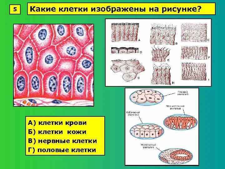 Какая клетка изображена. Клетки кожи. Какая клетка изображена на рисунке. Какая клетка игображены на рисунке.