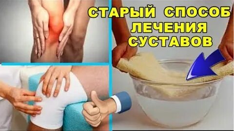 Лечение артроза компрессом