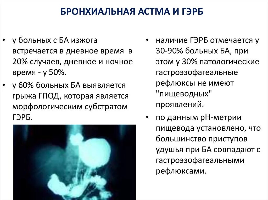 Рефлюкс рекомендации. Бронхиальная астма при ГЭРБ. Симптомы при ГЭРБ. ГЭРБ И бронхиальная астма дифференциальная диагностика. Рефлюкс-индуцированная бронхиальная астма.