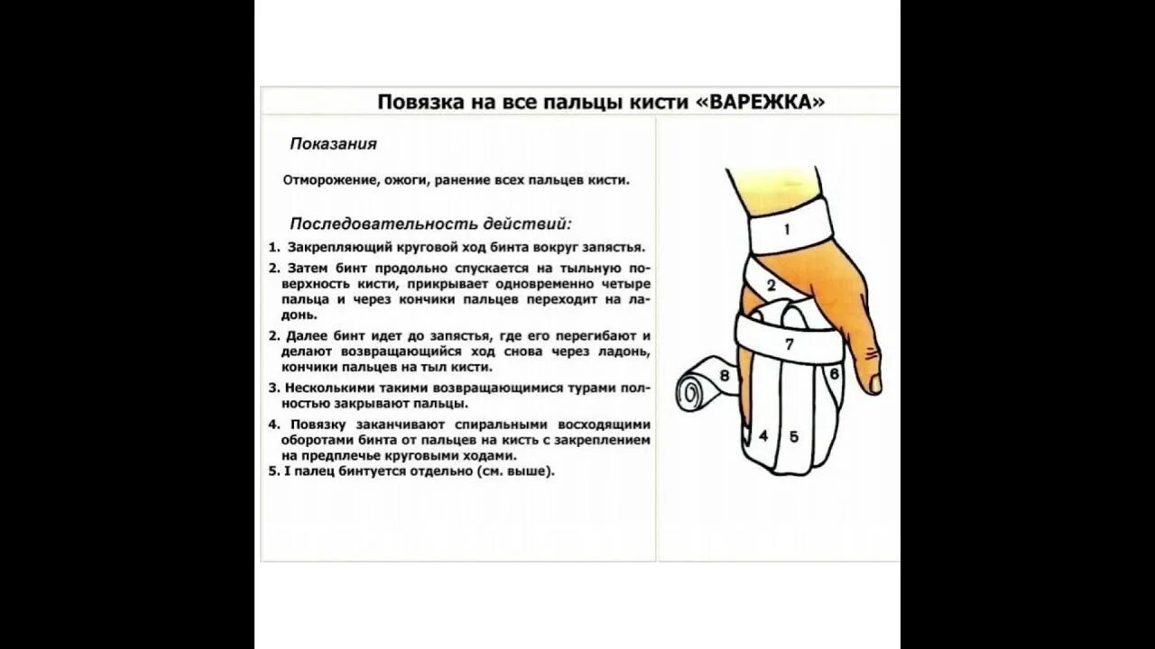 Техника наложения повязки перчатка